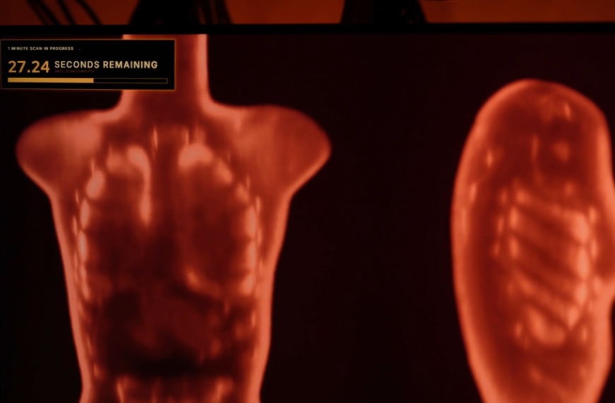 A imagem mostra a tela de um monitor exibindo o que parece ser um escaneamento corporal ou médico em andamento. O fundo da tela é totalmente escuro, e duas silhuetas humanas aparecem brilhando em tons de vermelho e laranja, lembrando uma imagem térmica ou de raio-X.