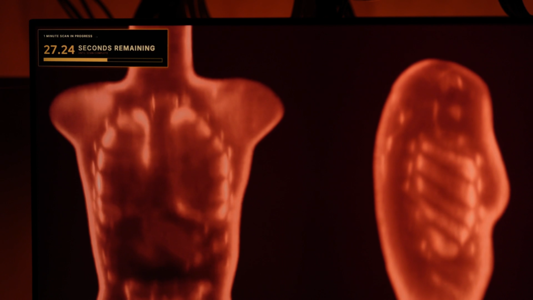 A imagem mostra a tela de um monitor exibindo o que parece ser um escaneamento corporal ou médico em andamento. O fundo da tela é totalmente escuro, e duas silhuetas humanas aparecem brilhando em tons de vermelho e laranja, lembrando uma imagem térmica ou de raio-X.